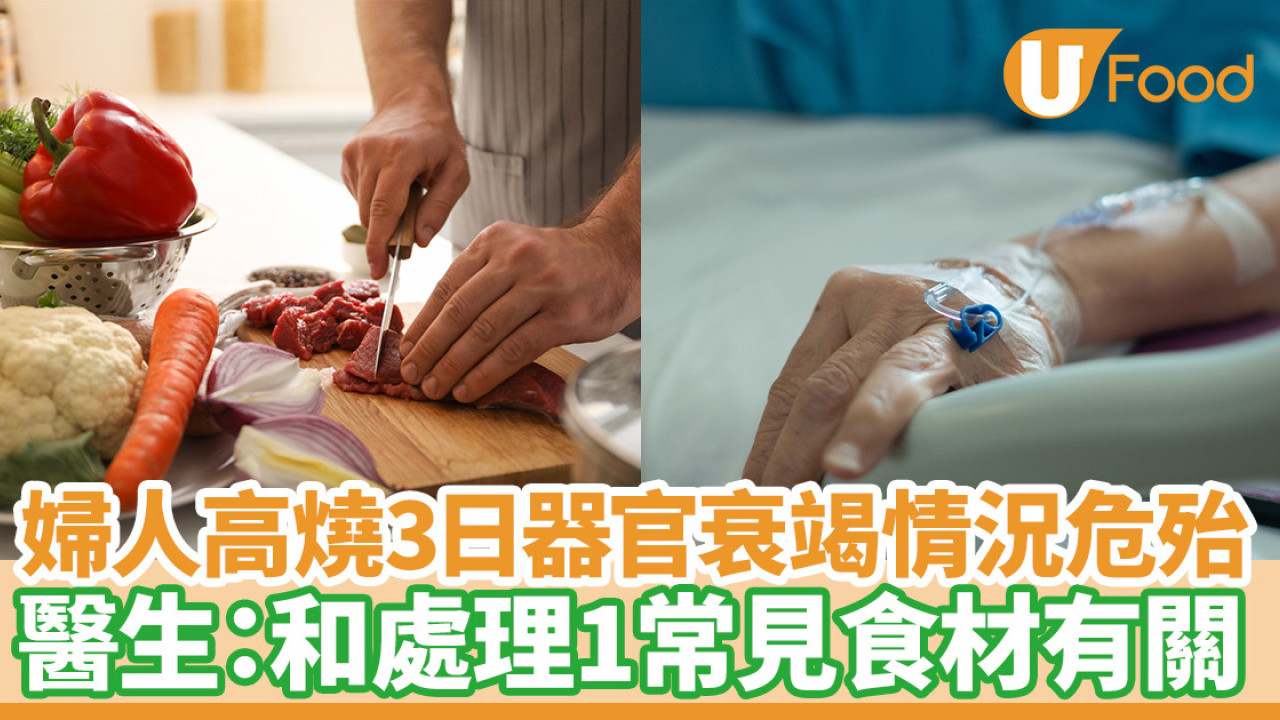 婦人持續高燒器官衰竭情況危殆  醫生：病因和處理1常見食材有關