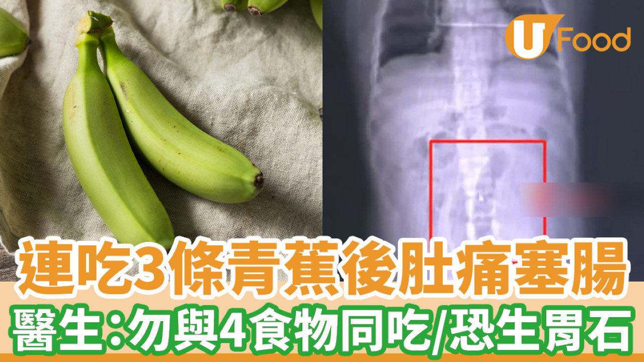 男子連吃3條青蕉肚痛塞腸 醫生：勿與4食物同吃 可生胃石