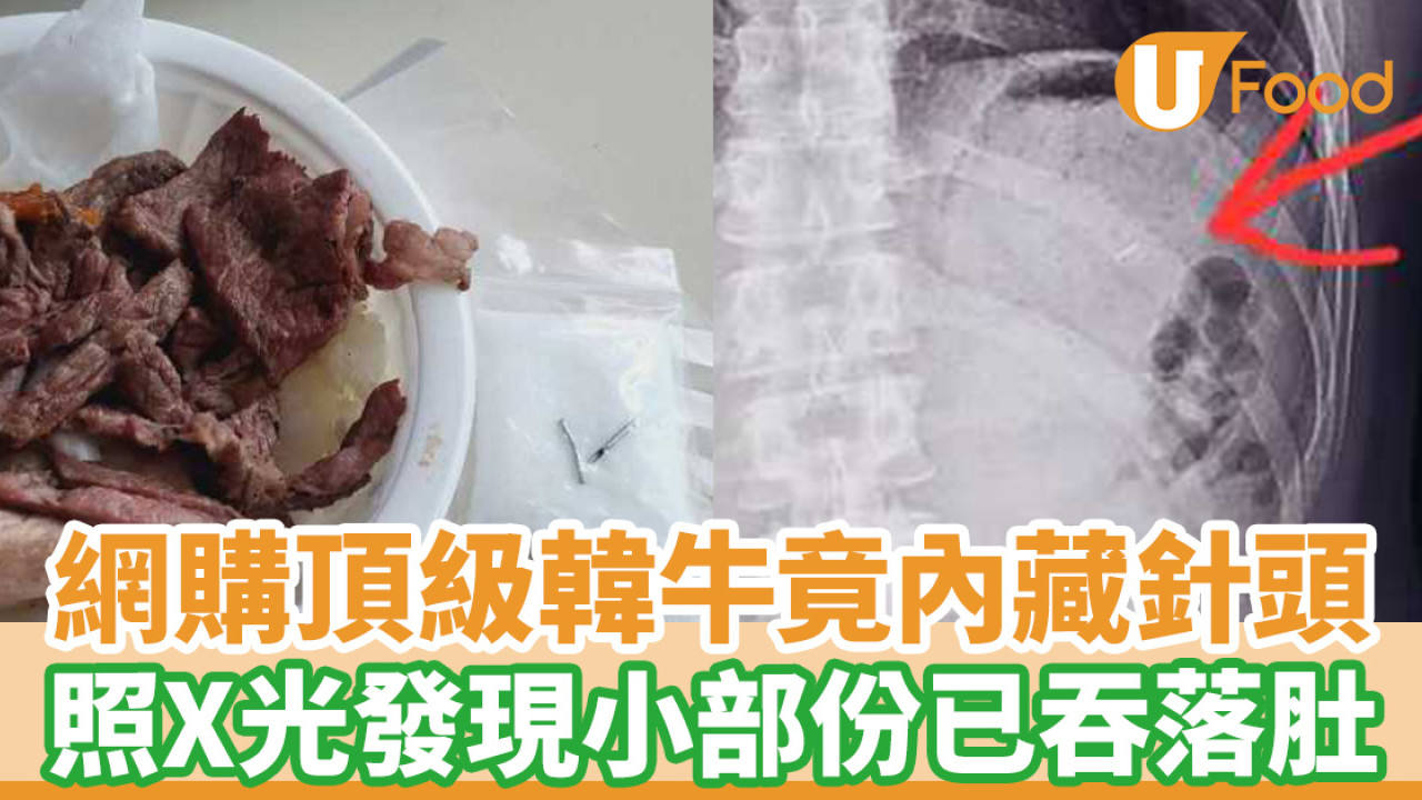 網購頂級韓牛竟內藏針頭 照X光發現小部份已吞下肚