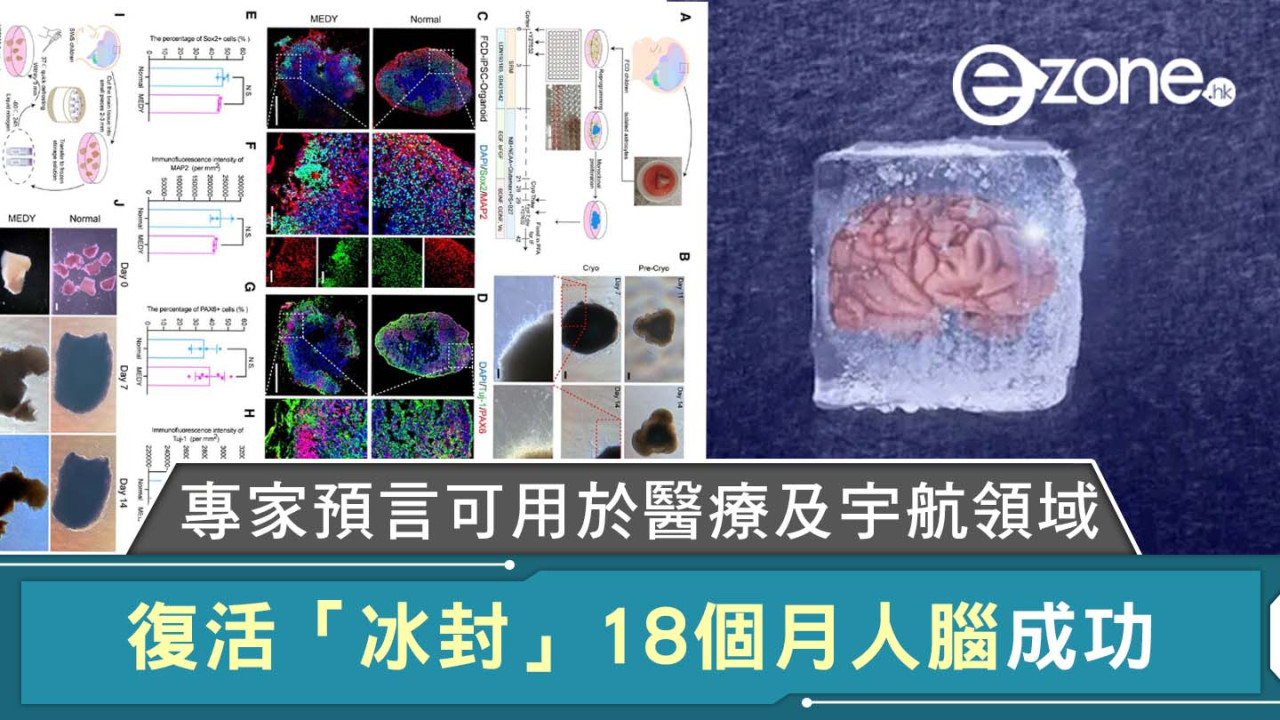 復活「冰封」18 個月人腦成功｜專家預言可用於醫療及宇航領域！