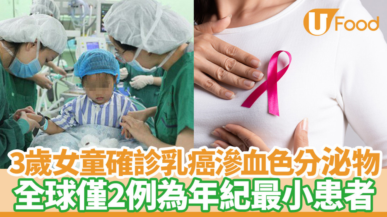 乳癌｜3歲女童確診乳腺癌滲血色分泌物  全球僅2例為年紀最小患者