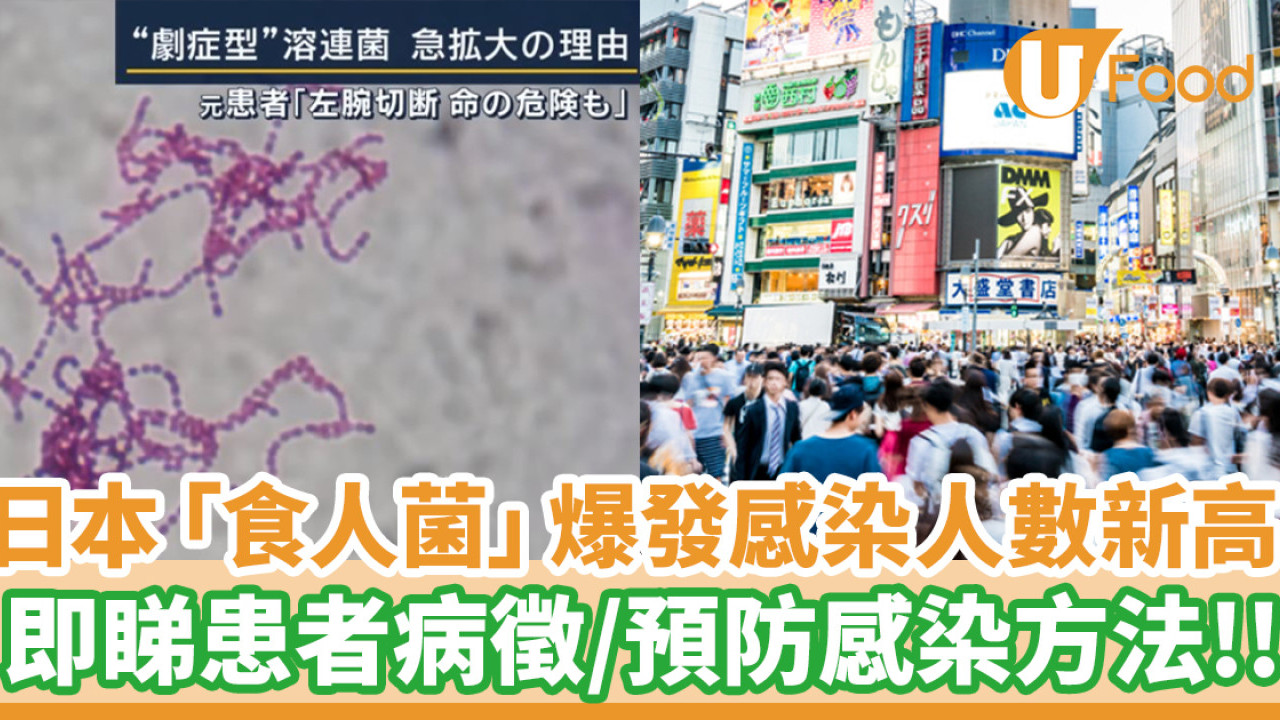 日本「食人菌」爆發感染人數創新高！即睇患者病徵／預防感染方法