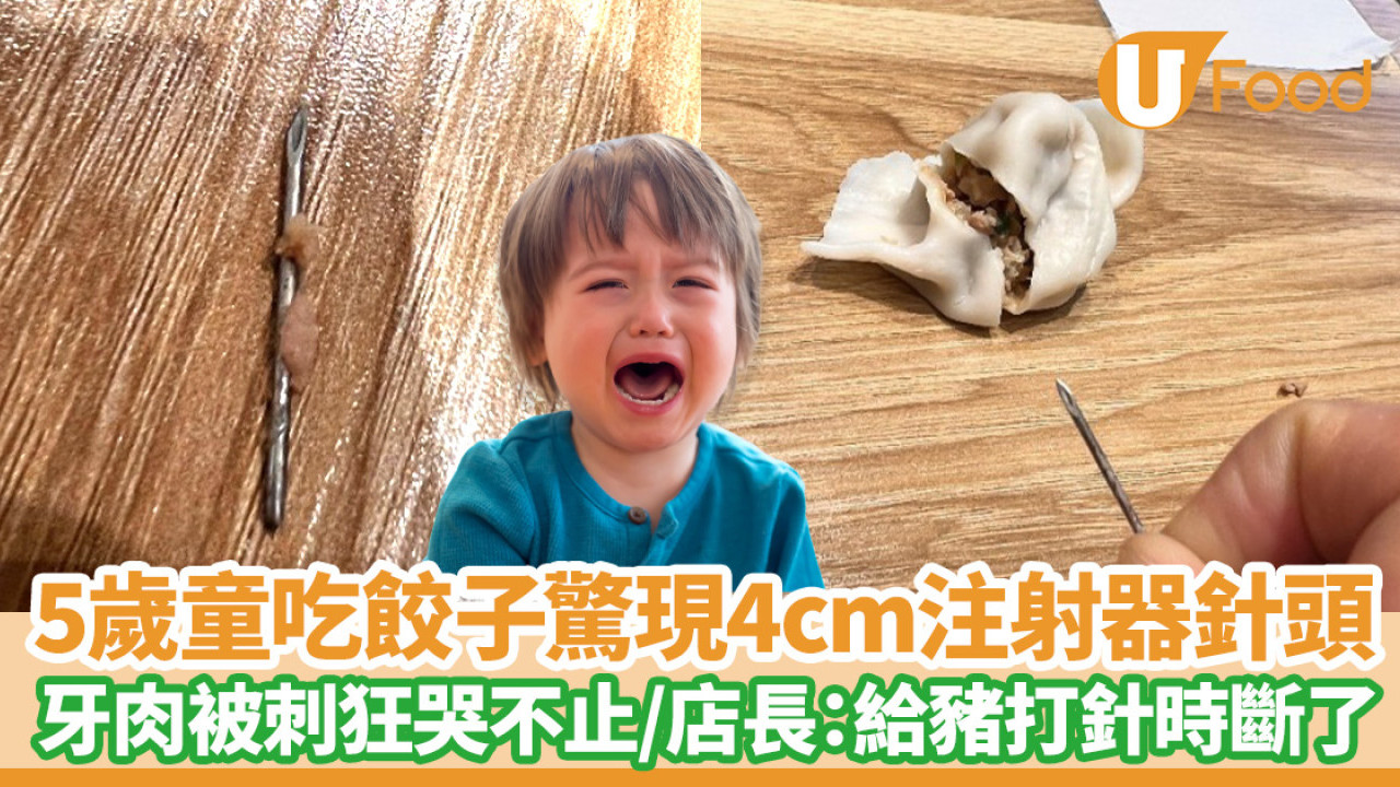 食物安全｜5歲童吃餃子驚現4cm針管！牙肉被刺狂哭不止  店長：給豬打針時斷了
