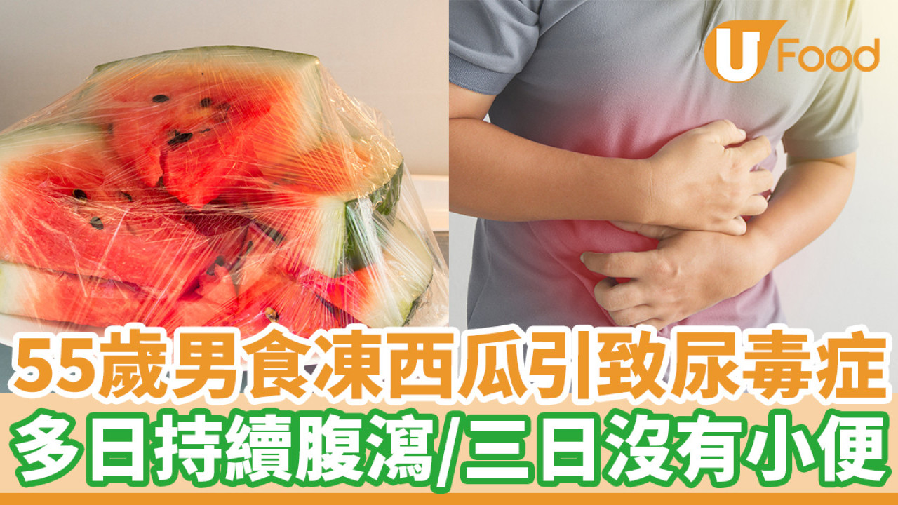 男子食凍西瓜引致尿毒症　持續腹瀉／三天沒有小便