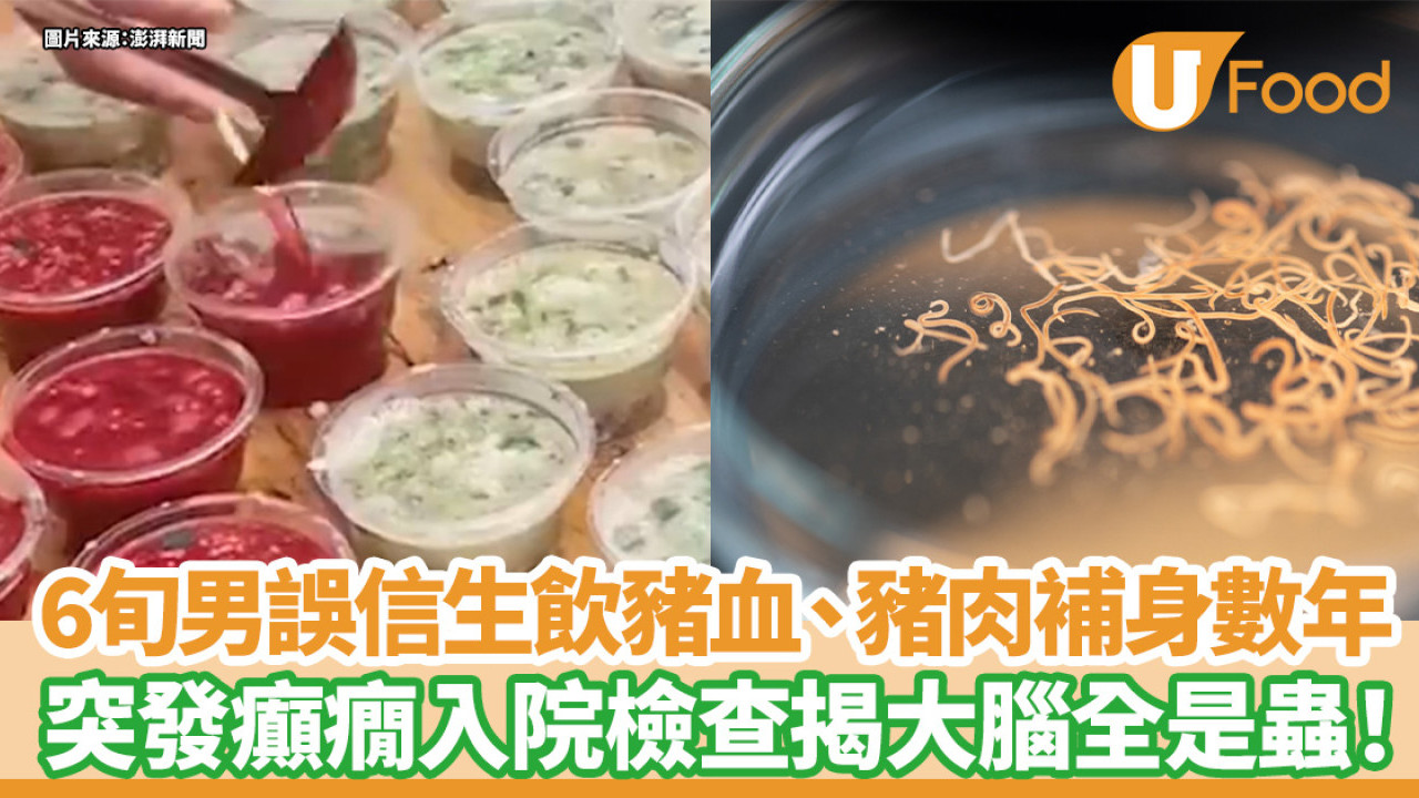 6旬男誤信偏方生飲豬血、豬肉補身數年  突發癲癇入院檢查揭大腦全是蟲！