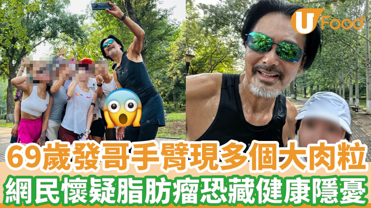 69歲周潤發手臂驚現多個大肉粒 網民懷疑脂肪瘤恐藏健康隱憂