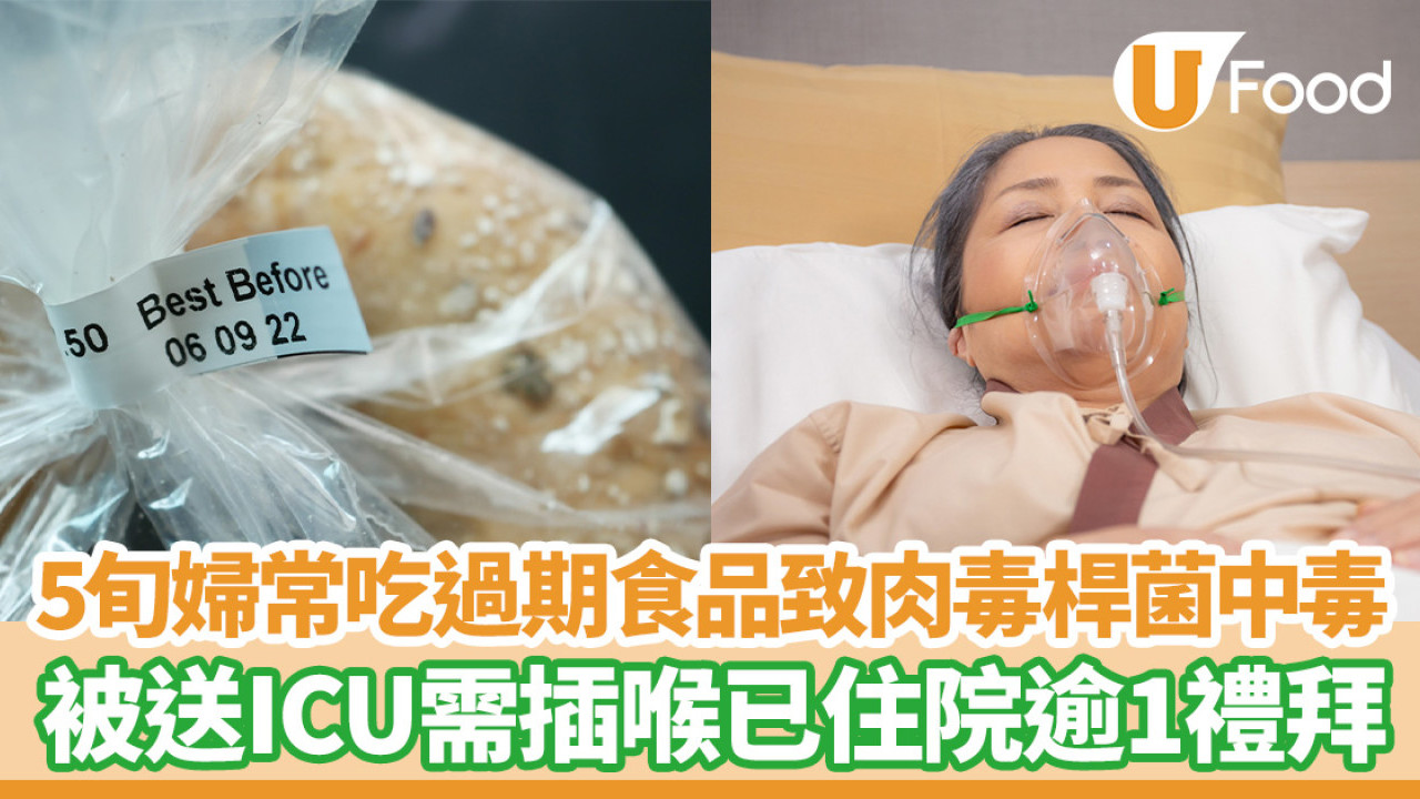 5旬婦常吃過期食品致肉毒桿菌中毒！發音吞嚥困難被送ICU需插喉用呼吸機