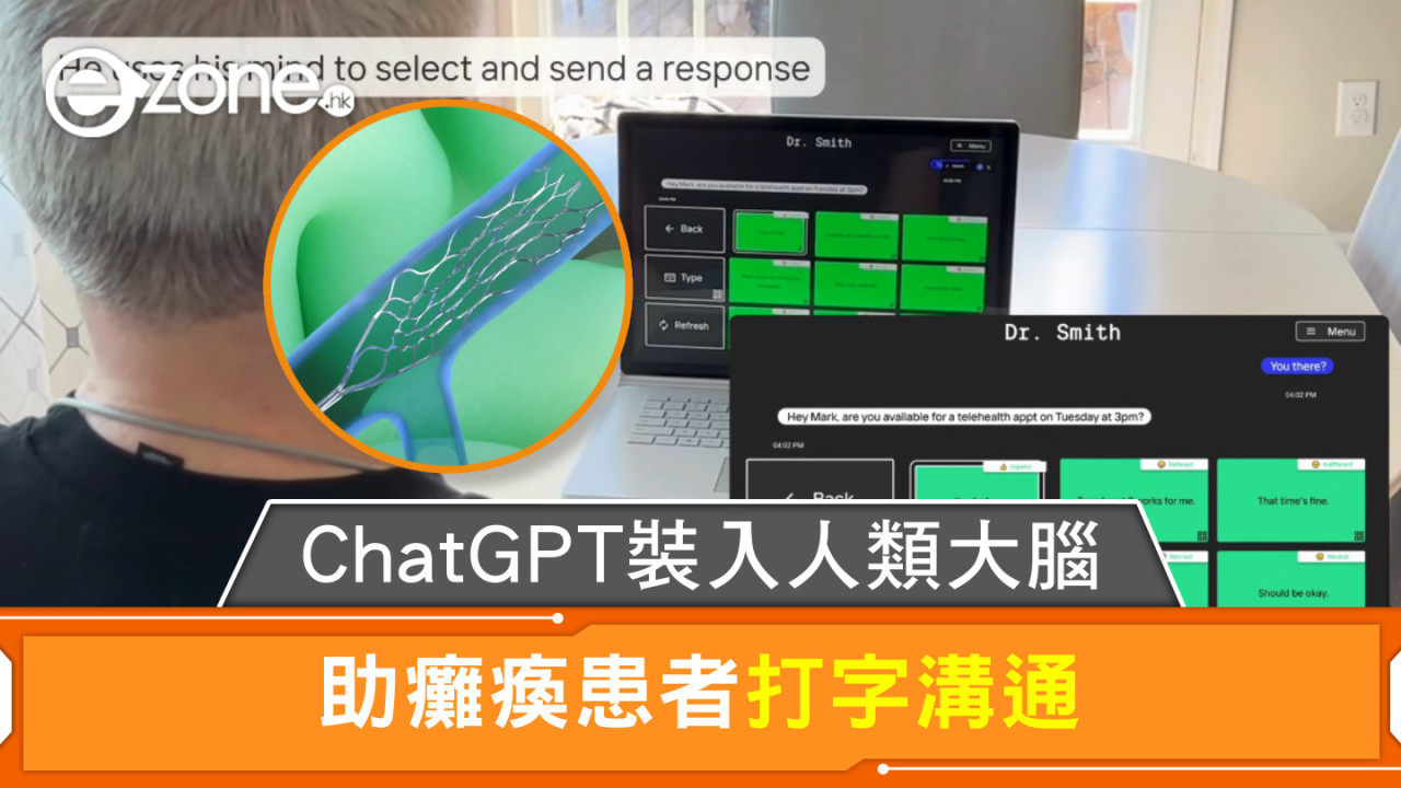 ChatGPT不再局限於手機！腦機介面技術 助癱瘓患者實現「意念打字」