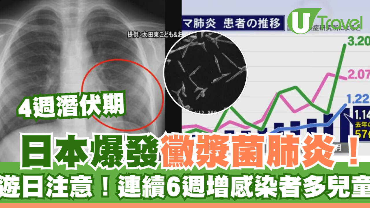 遊日注意｜日本再爆發「黴漿菌肺炎」！創近10年新高！一類人最高危