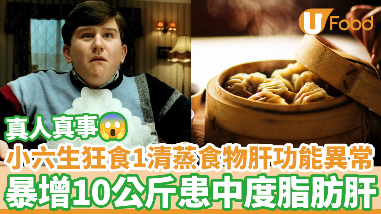 小六生狂食1清蒸食物肝功能異常 暴增10公斤患中度脂肪肝