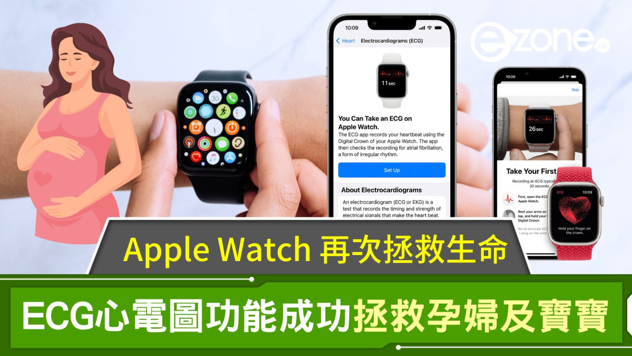 Apple Watch再次拯救生命！ECG心電圖功能成功拯救孕婦及寶寶