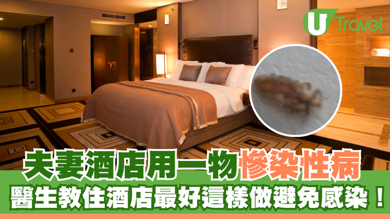 夫妻酒店用一物慘染性病 醫生教住酒店必學自保法避免感染！ 