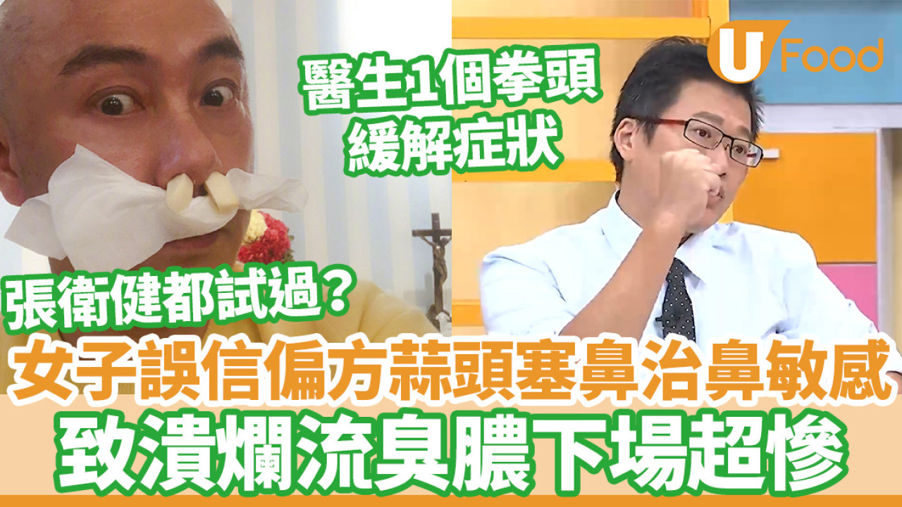 女子誤信偏方蒜頭塞鼻治鼻敏感 致潰爛流臭膿/醫生教1個拳頭紓緩過敏症狀