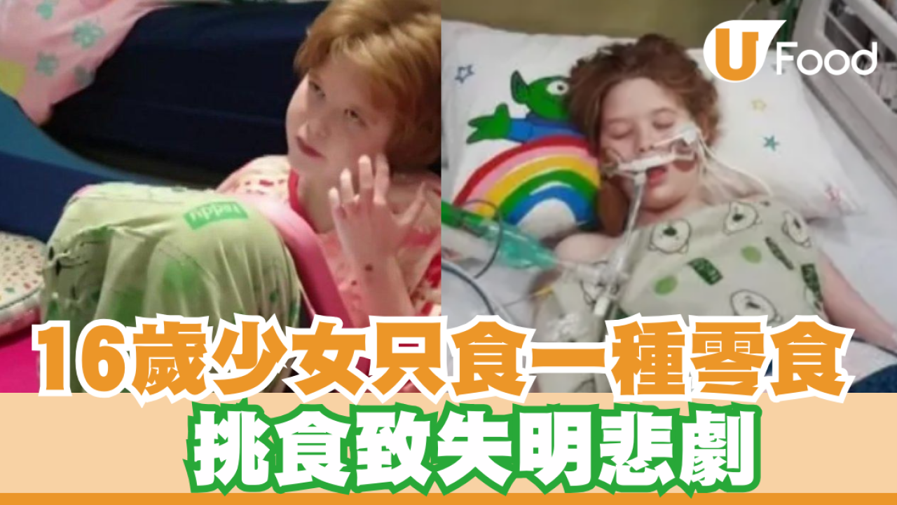 兒童偏食｜16歲少女只食一種零食  挑食致失明悲劇