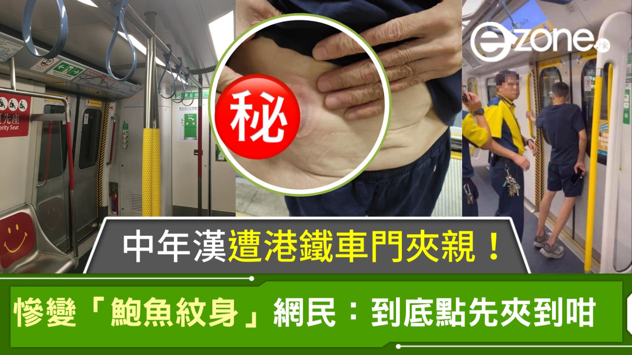 中年漢遭港鐵車門夾親！慘變「鮑魚紋身」網民：到底點先夾到咁