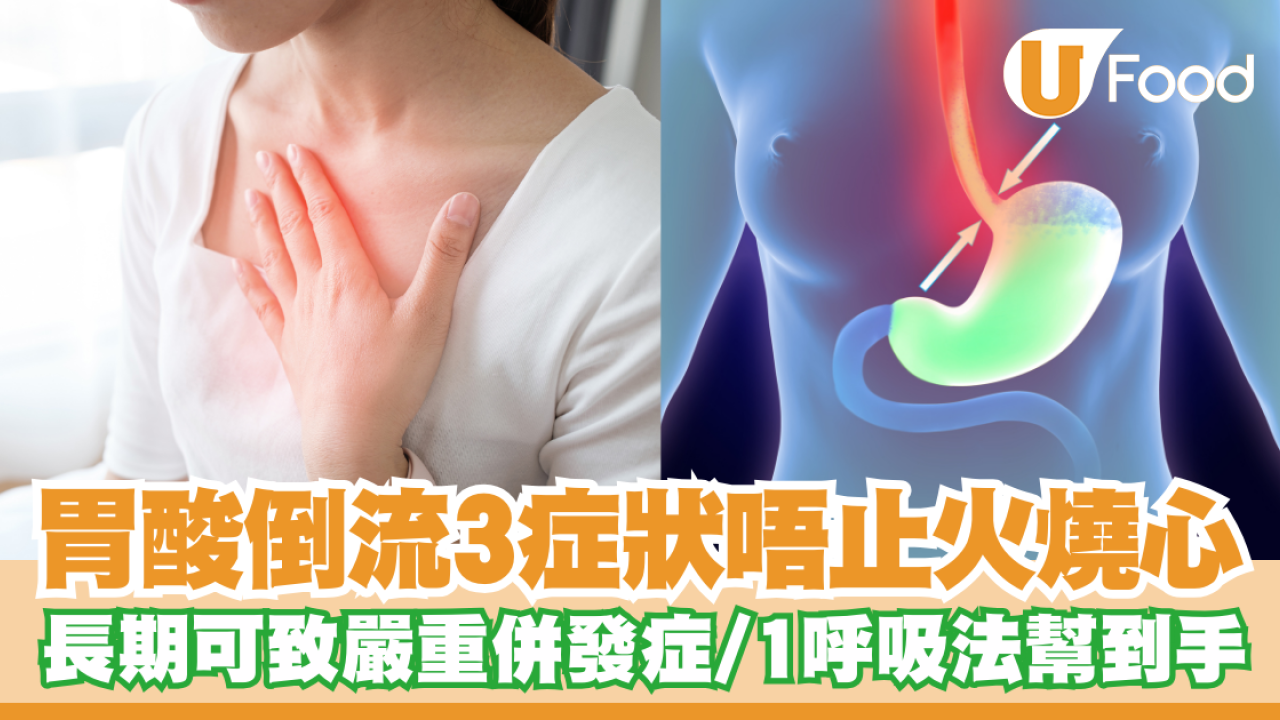 胃酸倒流3症狀唔止火燒心！長期可致嚴重併發症／醫生教1呼吸法幫到手