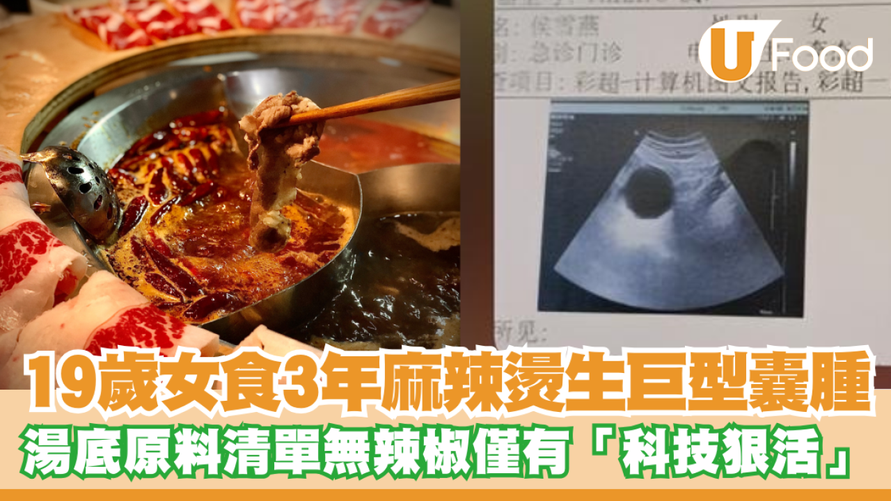 19歲女連食3年麻辣燙生巨型囊腫！原料清單被起底當中無辣椒僅有「科技狠活」