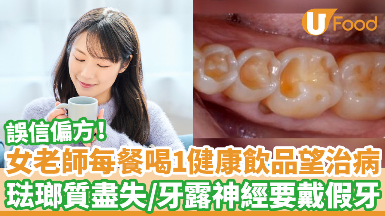 女老師每餐喝1健康飲品望治病 琺瑯質盡失/牙露神經要戴假牙