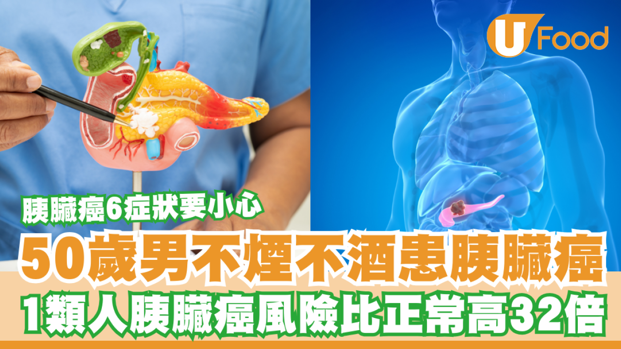 50歲男不煙不酒患胰臟癌！1類人胰臟癌風險比正常高32倍／胰臟癌6症狀要小心