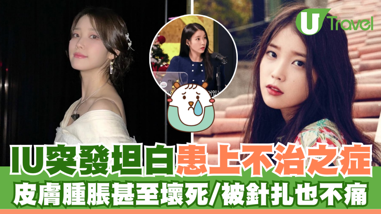 IU坦白患上不治之症 皮膚腫脹甚至壞死/被針扎也不痛