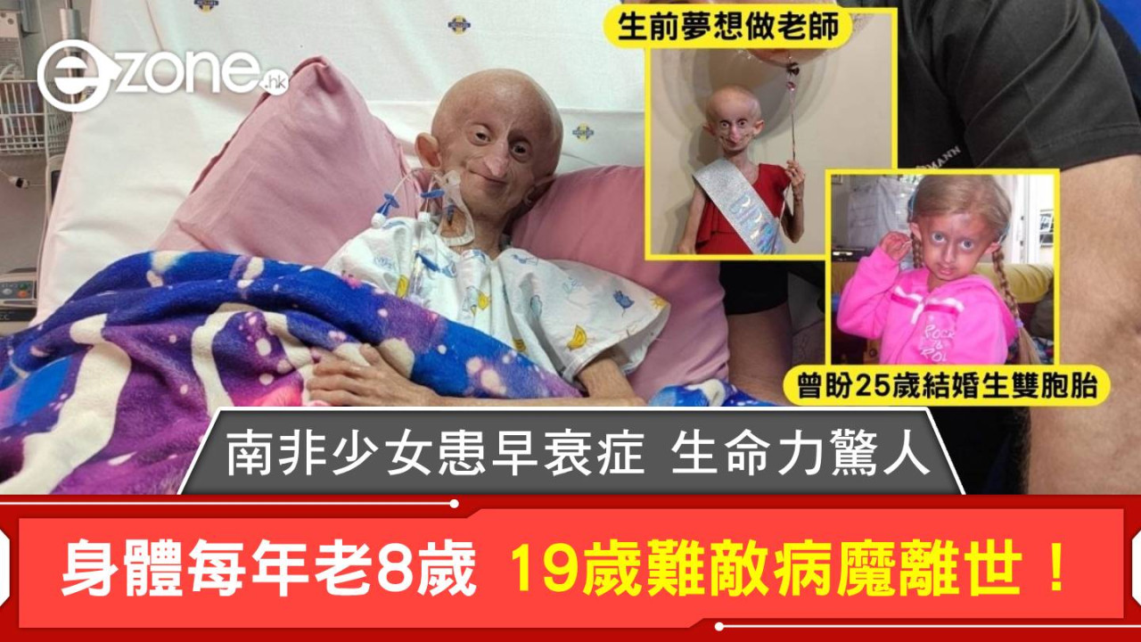 南非少女患早衰症生命力驚人 身體每年老8歲 19歲難敵病魔離世！ 