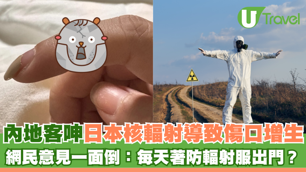 內地客呻日本核輻射導致傷口增生 網民意見一面倒：每天著防輻射服出門？