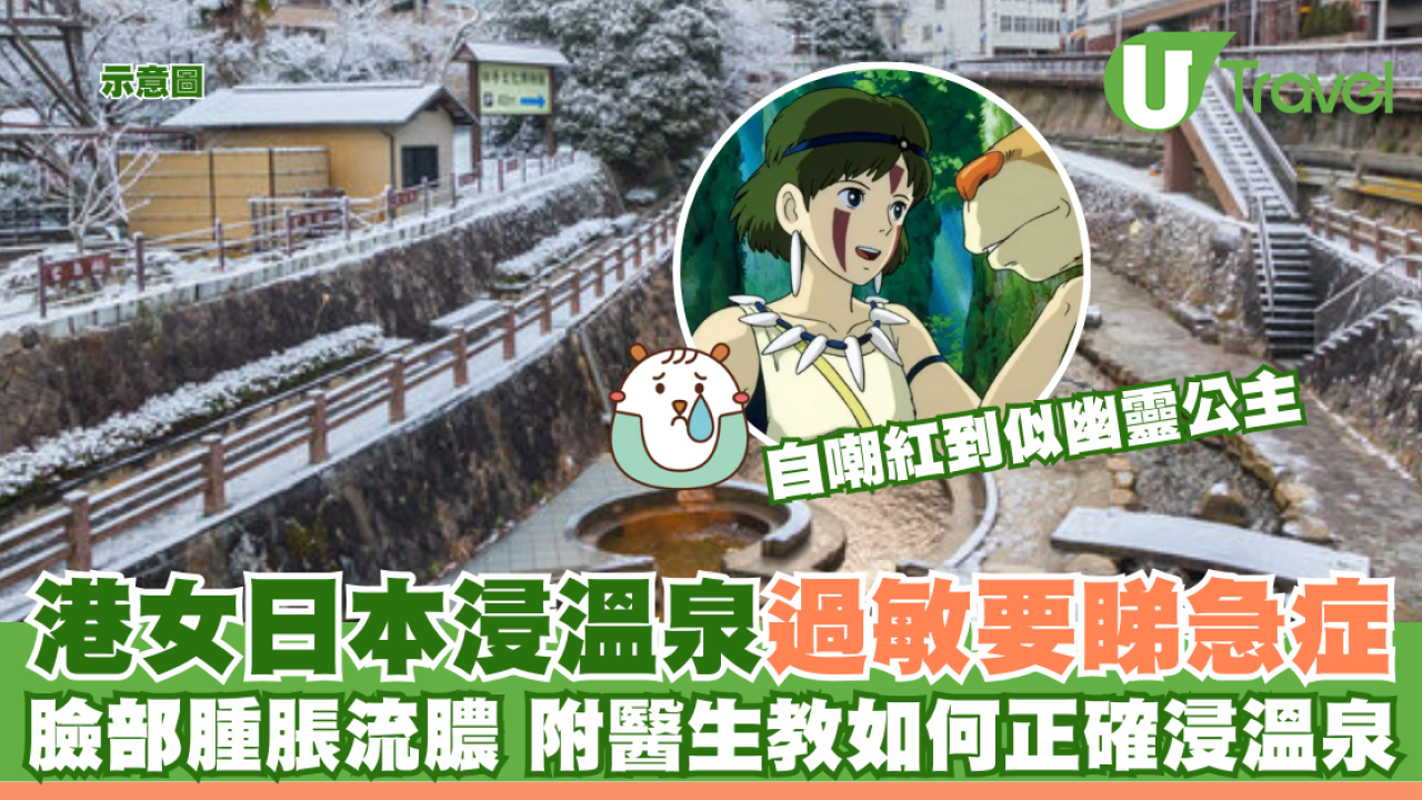 港女日本浸溫泉敏感要睇急症 臉部腫脹流膿 附醫生教如何正確浸溫泉