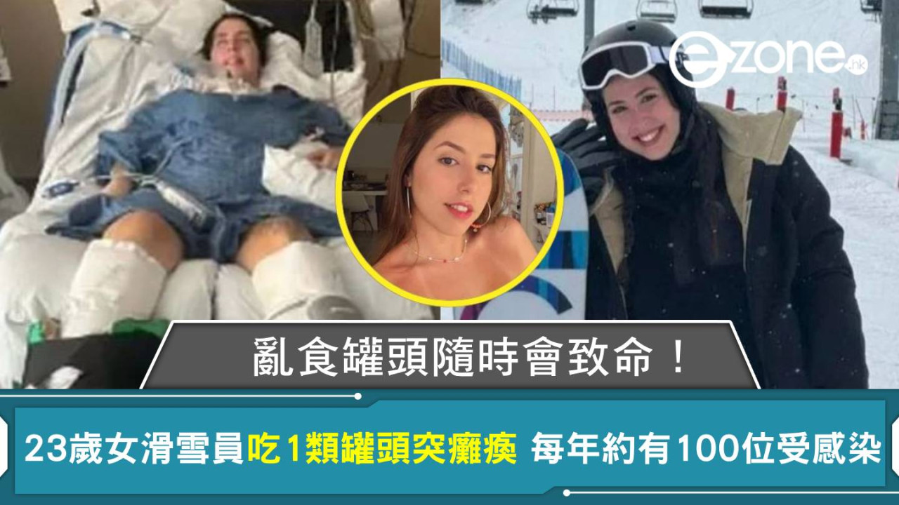 亂食罐頭隨時會致命！23歲女滑雪員吃1類罐頭突癱瘓 每年約有100位受感染