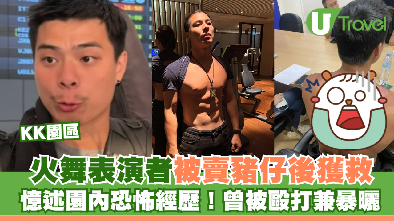 KK園區｜火舞表演者被賣豬仔後獲救 憶述園內恐怖經歷！曾被毆打兼暴曬 