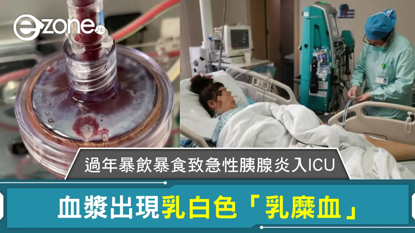 過年暴飲暴食致急性胰腺炎  女子劇烈腹痛入 ICU