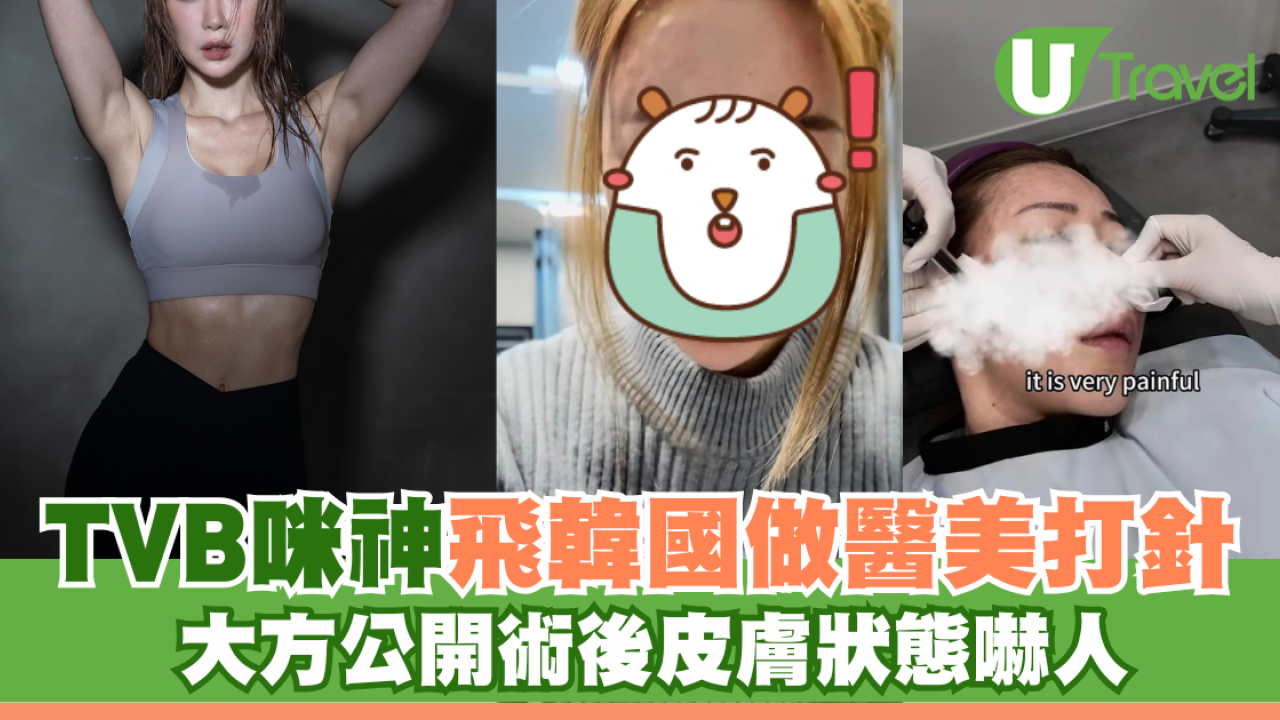 TVB咪神飛韓國做醫美打針 大方公開術後皮膚狀態嚇人