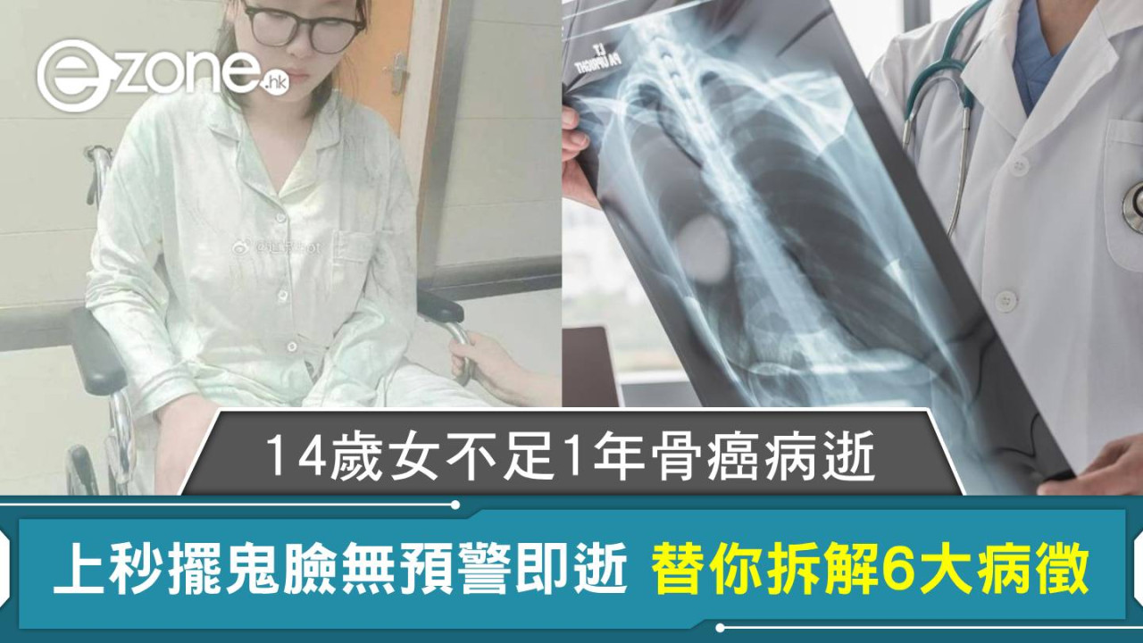 14歲女不足1年骨癌病逝 上秒擺鬼臉無預警即逝 替你拆解6大病徵