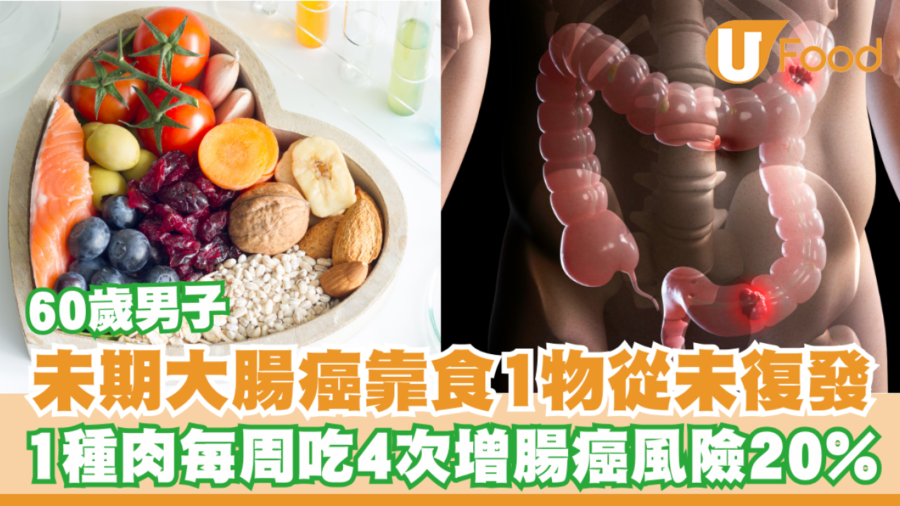 大腸癌｜60歲男末期大腸癌靠食1物從未復發！1種肉每周吃4次增腸癌風險20%