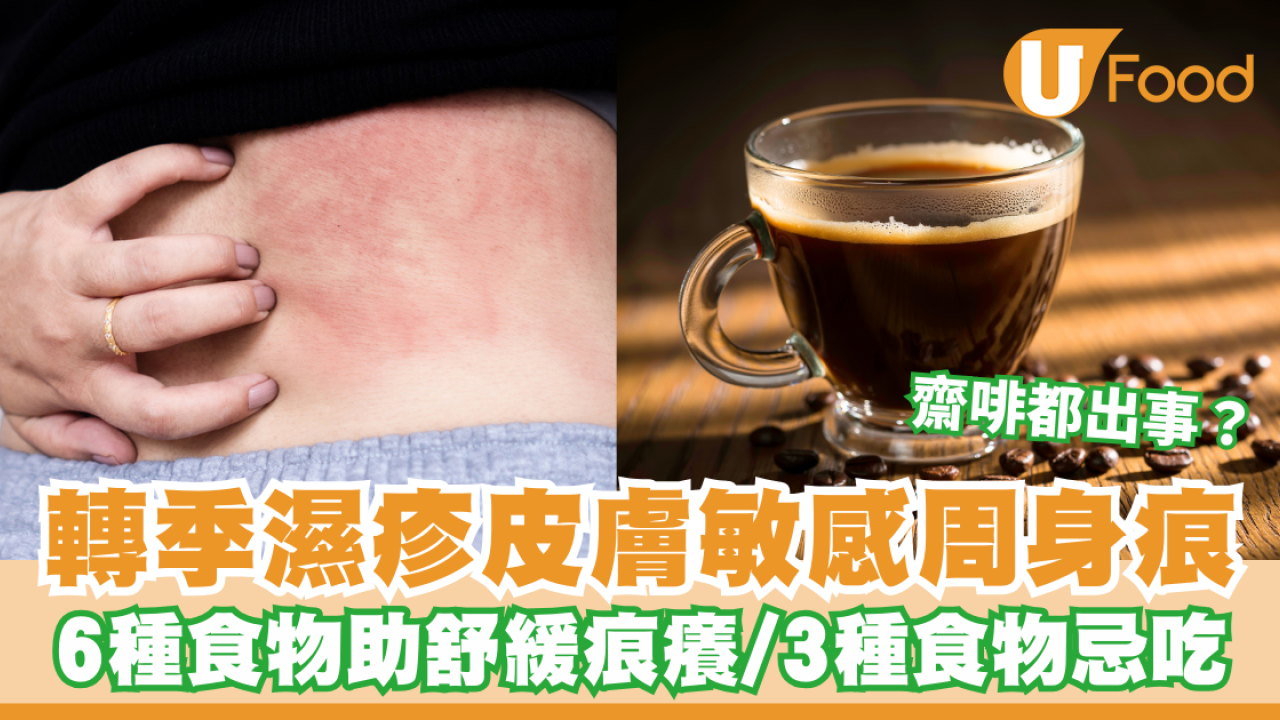轉季濕疹皮膚敏感周身痕！6種食物助舒緩 3種食物忌吃／齋啡都出事？