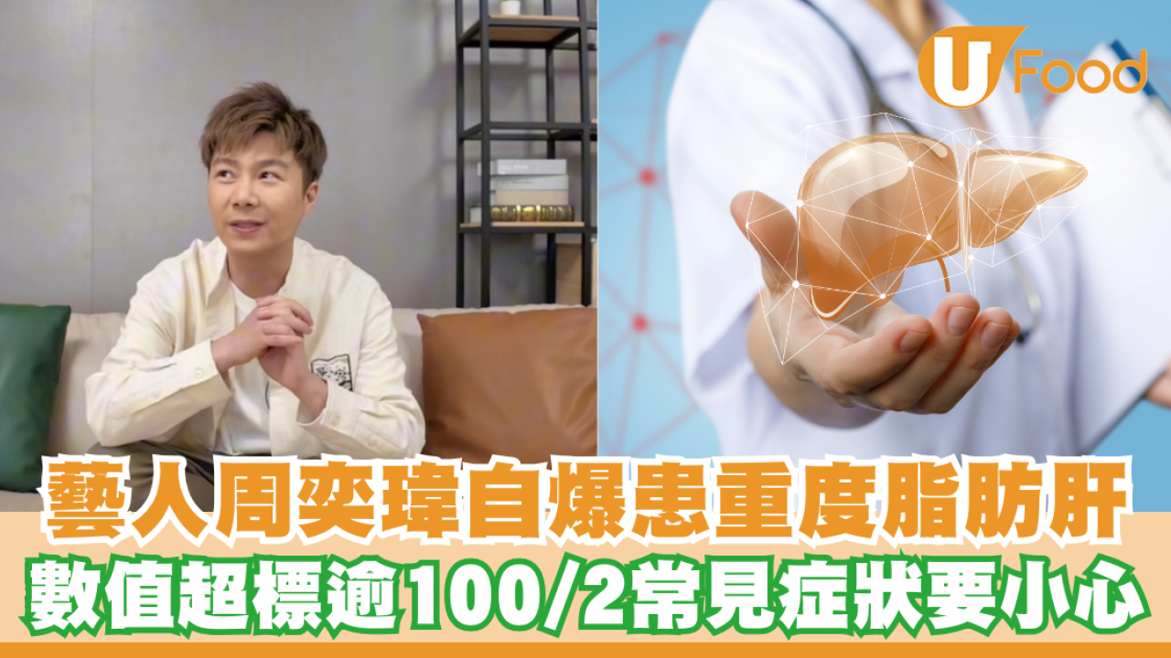 脂肪肝｜tvb藝人周奕瑋自爆患重度脂肪肝！數值超標逾100／中2常見症狀要小心