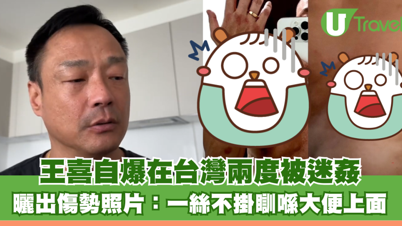 王喜自爆在台灣兩度被迷姦 曬出傷勢照片：一絲不掛瞓喺大便上面