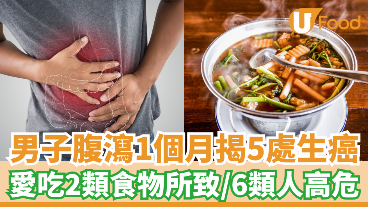 男子腹瀉1個月揭5處生癌 愛吃2類食物所致！6類人高危