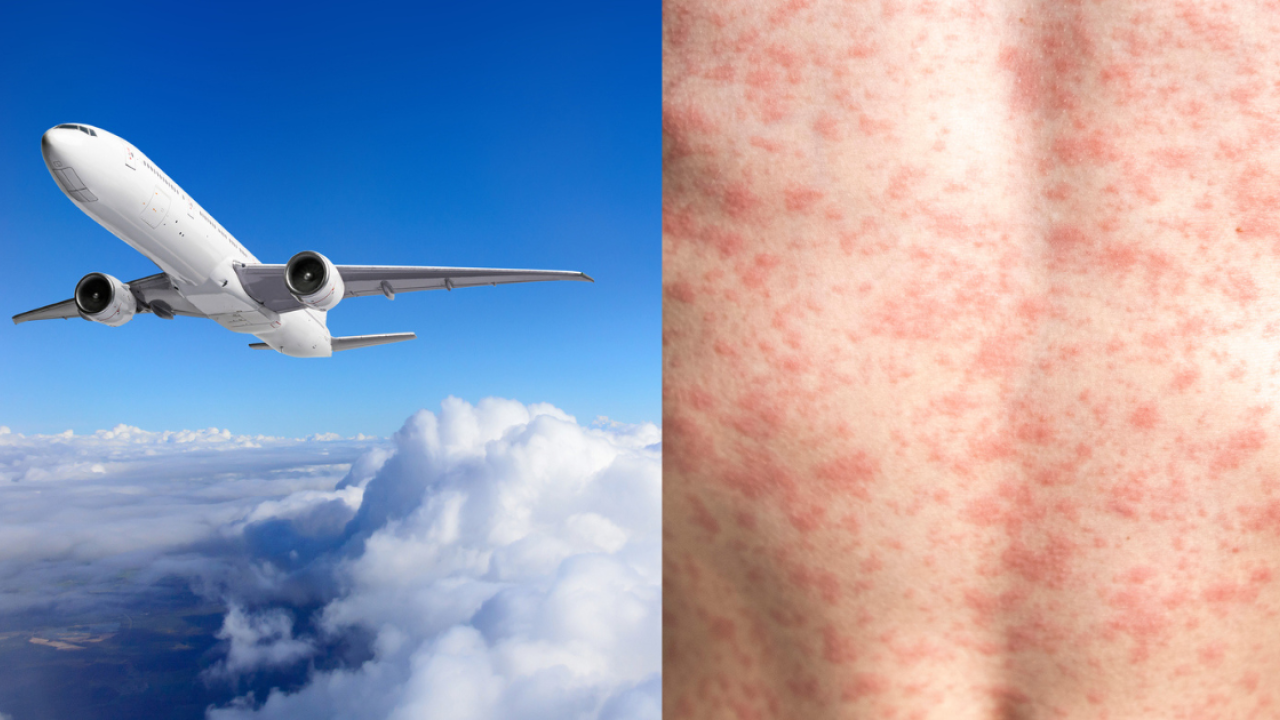 港人熱門旅遊地區相繼爆麻疹！日韓台越病例激增！外遊返港現此徵狀要即求醫