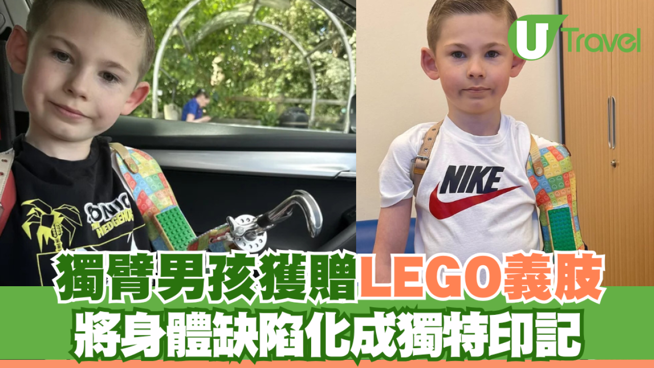 獨臂男孩獲贈LEGO義肢 將身體缺陷化成獨特印記