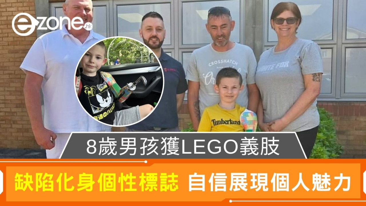 8歲男孩獲LEGO義肢｜缺陷化身個性標誌 自信展現個人魅力