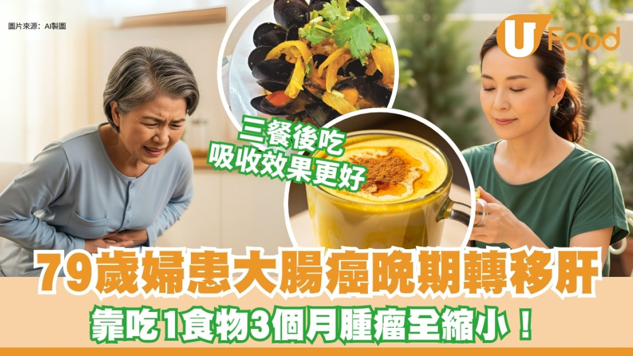 79歲婦患大腸癌晚期吃1香料腫瘤縮小五倍！中醫︰三餐後吃吸收更好
