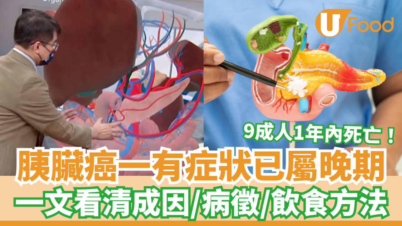 胰臟癌一有症狀已屬晚期9成人1年內死亡 一文看清胰臟癌成因／病徵／飲食方法（附食譜）