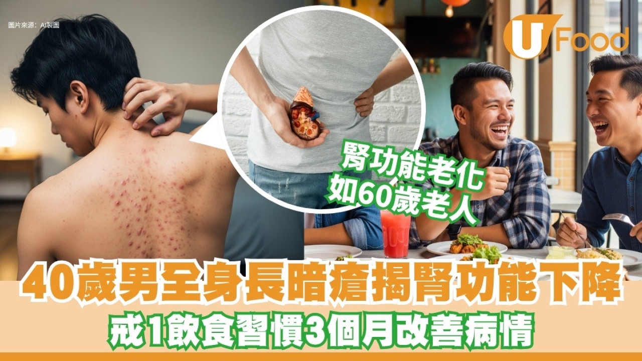 全身長暗瘡或腎衰！40歲男愛吃1食物傷腎老化如六旬 醫生3招改善