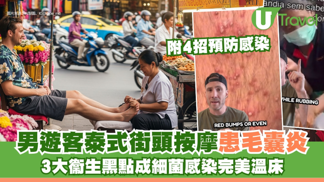 泰國街頭按摩藏危機！遊客雙腿爆膿確診毛囊炎！4招預防細菌感染！