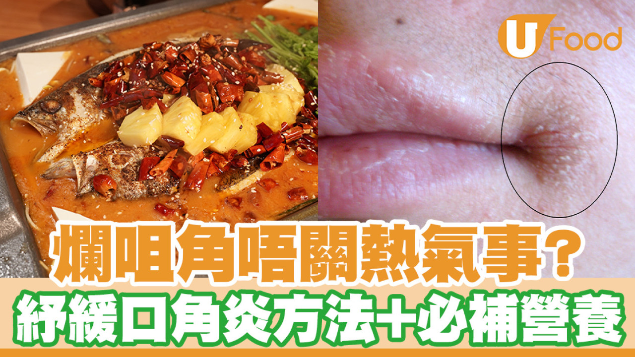 【爛嘴角原因】爛嘴角代表熱氣？ 一文看清口角炎紓緩方法＋必補營養