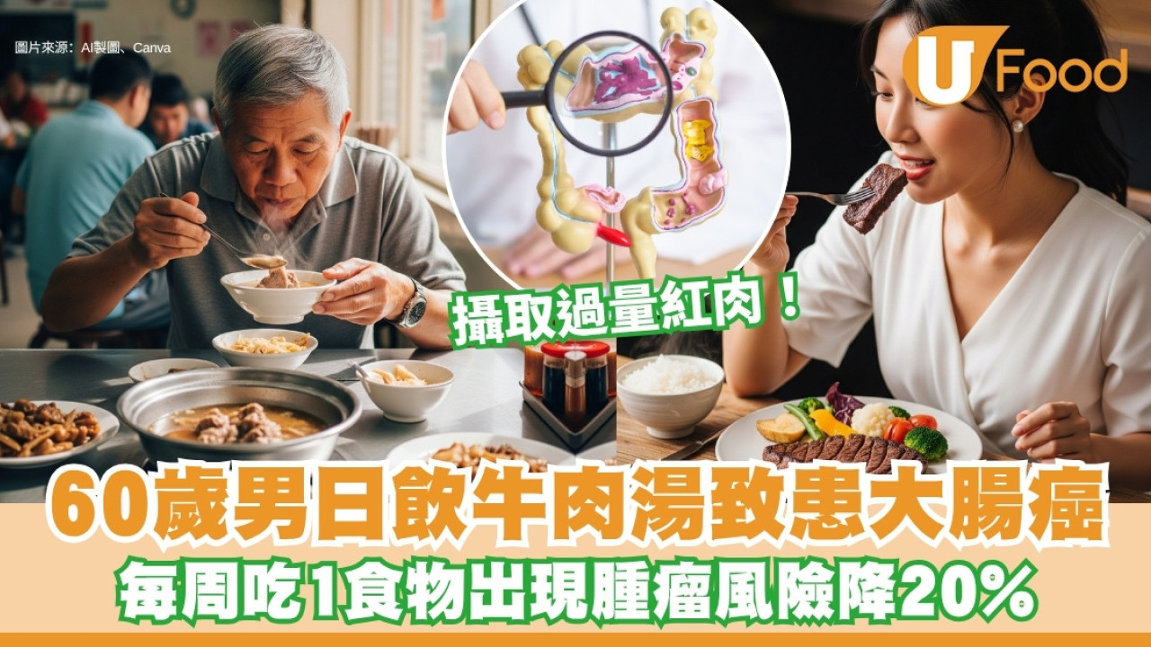 60歲男每朝必喝牛肉湯致患大腸癌 每周吃1食物出現腫瘤風險降低20%