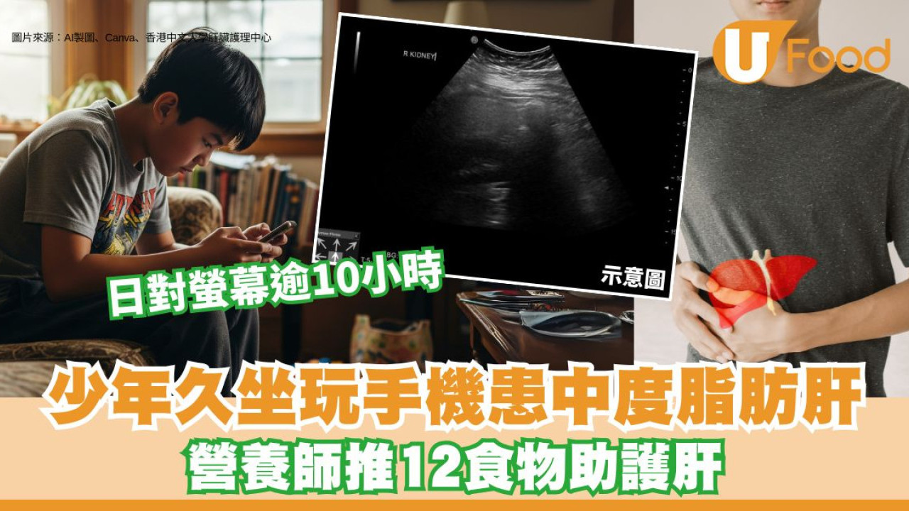 13歲少年久坐玩手機逾10小時 確診中度脂肪肝！營養師推12食物助護肝