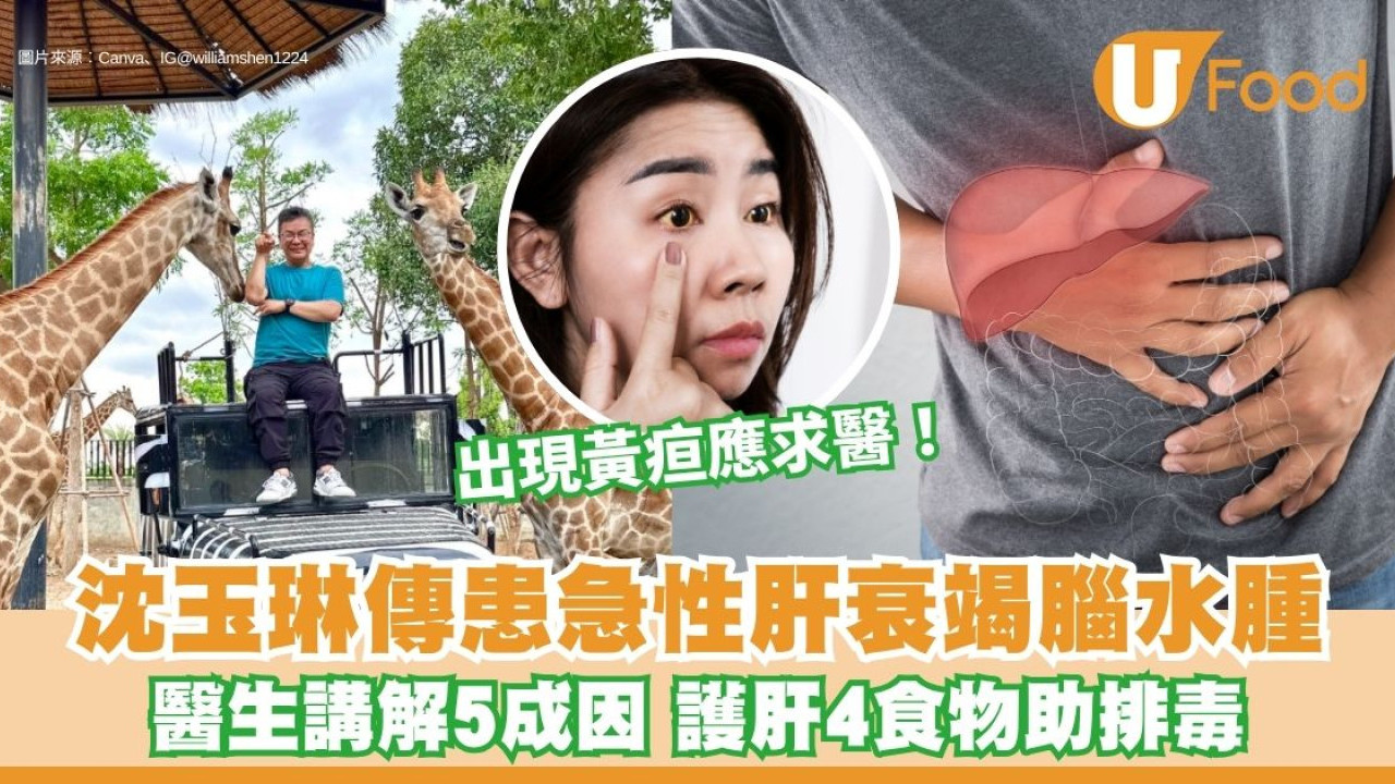 沈玉琳傳患急性肝衰竭引發腦水腫 醫生講解5成因 出現黃疸急就醫！