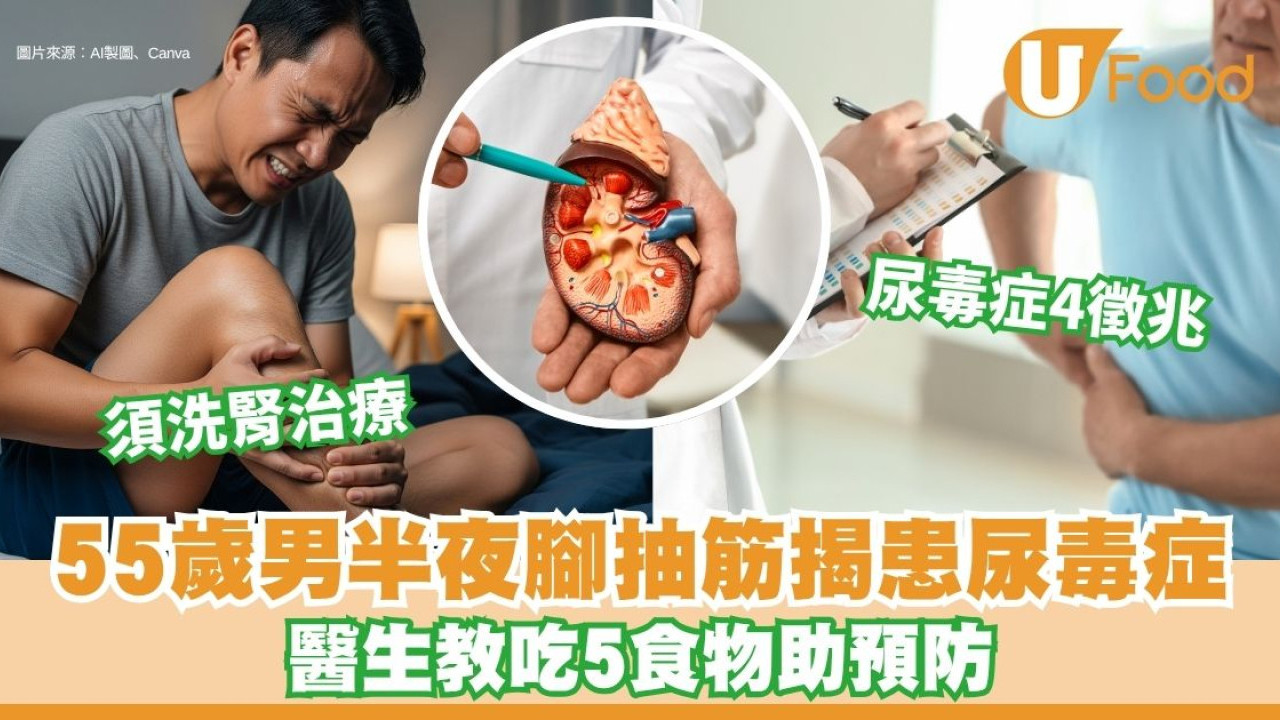 55歲男半夜瞓覺腳抽筋 揭患尿毒症須洗腎【附5食物預防半夜腳抽筋】