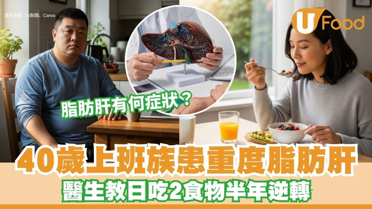 有脂肪肝不能吃什麼？40歲上班族患重度脂肪肝 日吃2食物半年逆轉